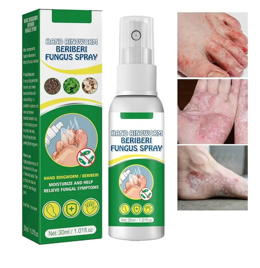 Hand Ringworm Beriberi Fungus Spray (Original)